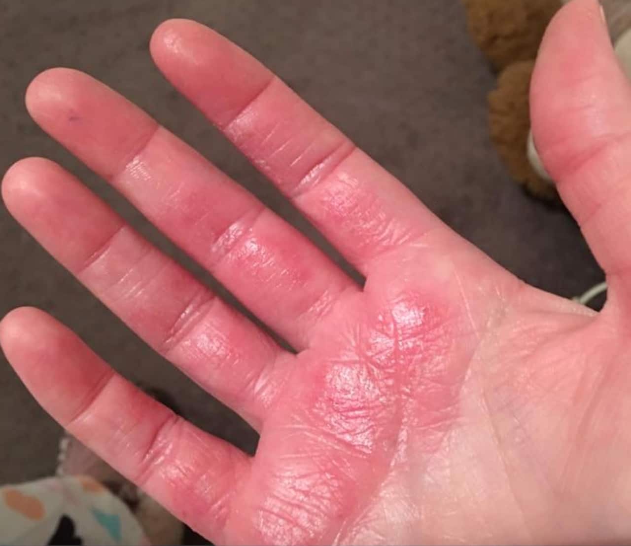 skin care during Covid-19