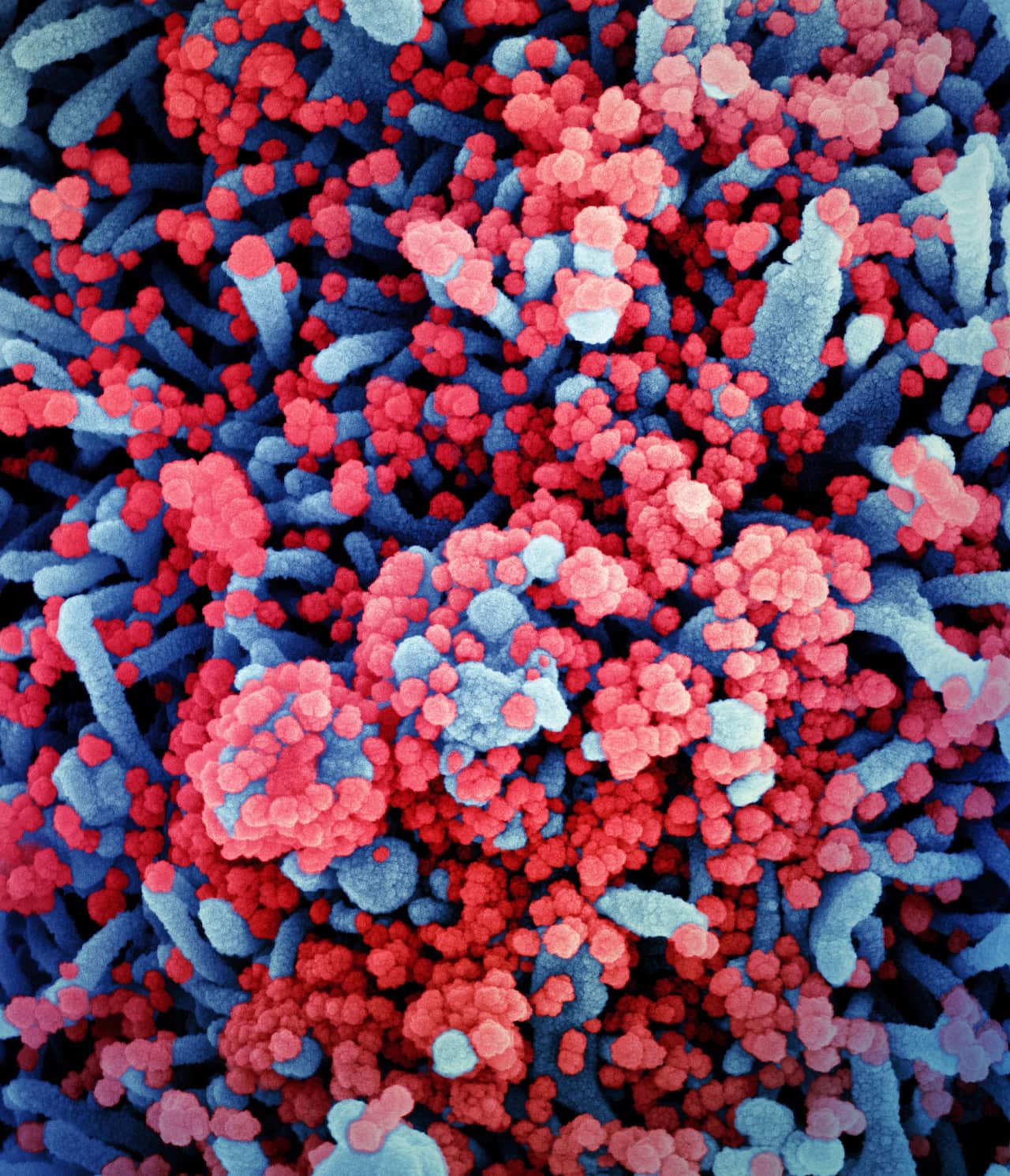 Novel coronavirus sars-cov-2
