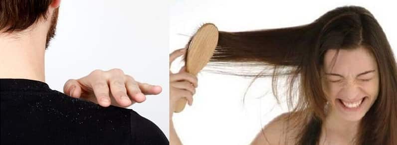 Dandruff, dry hair and split ends are some of the common hair problems