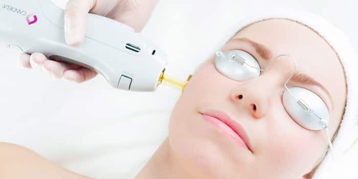 Laser treatment