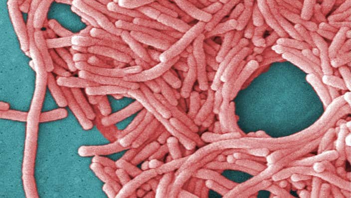 Legionnaire disease