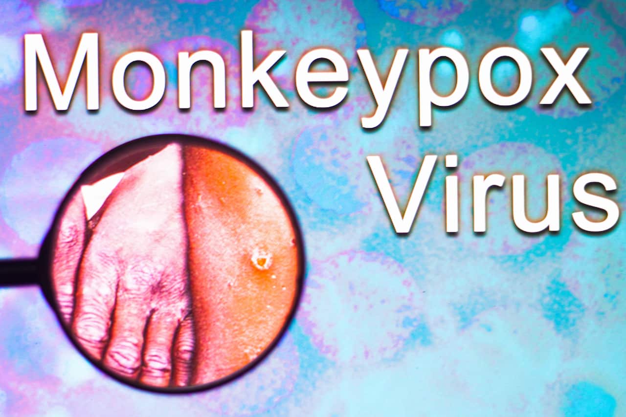 In this photo illustration, the word Monkeypox virus seen through a magnifying glass with a photo highlighted. It is a viral disease that occurs mainly in central and western Africa 