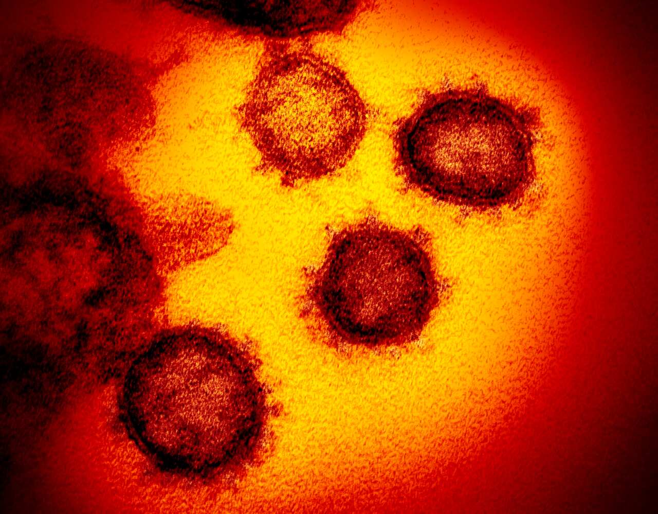 An electron microscope image of the Novel Coronavirus SARS-CoV-2, the virus that causes COVID-19 