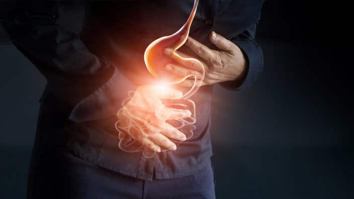 Bowel cancer