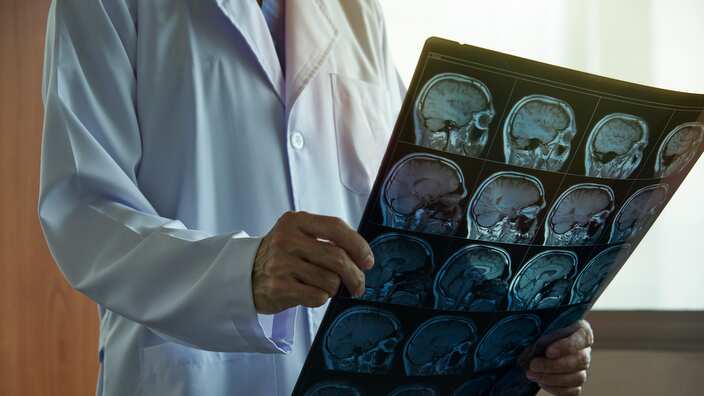 Doctor holding brain MRI in medical office