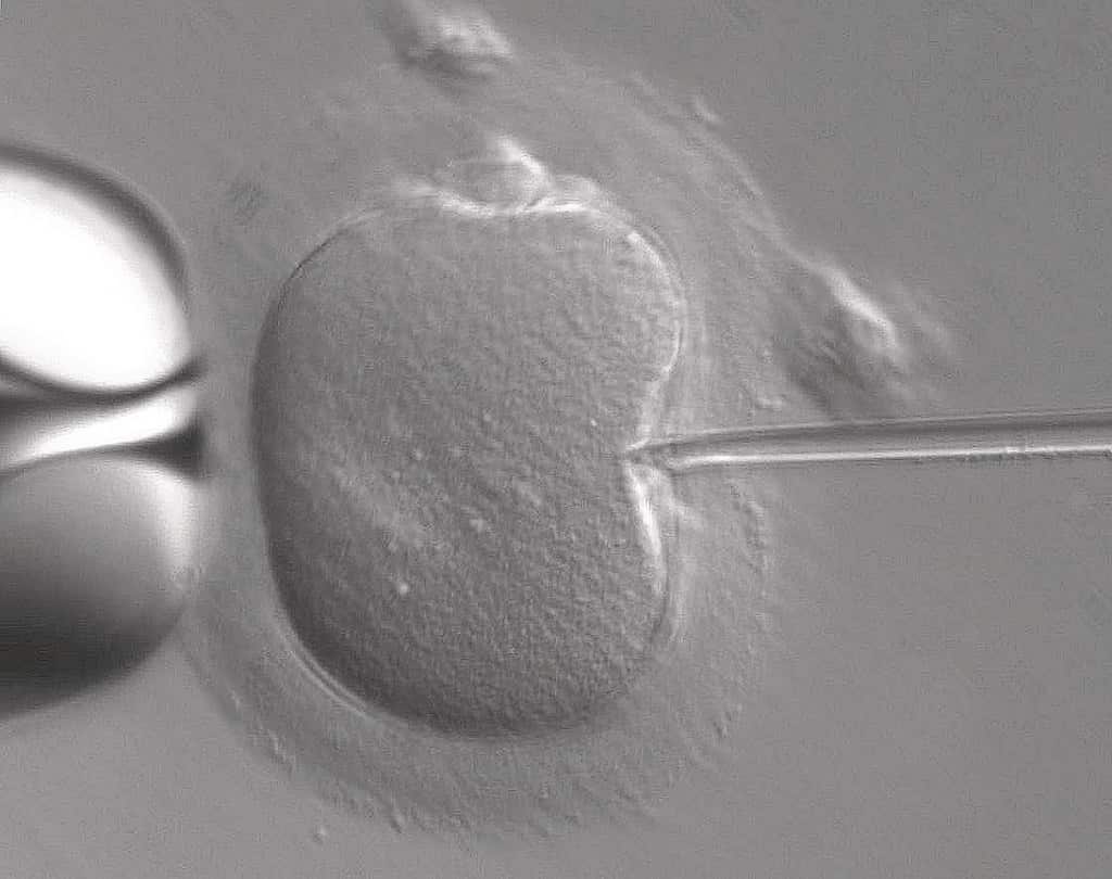 "IVF Capillary Tube Insertion" by ZEISS Microscopy is licensed under CC BY-NC-ND 2.0