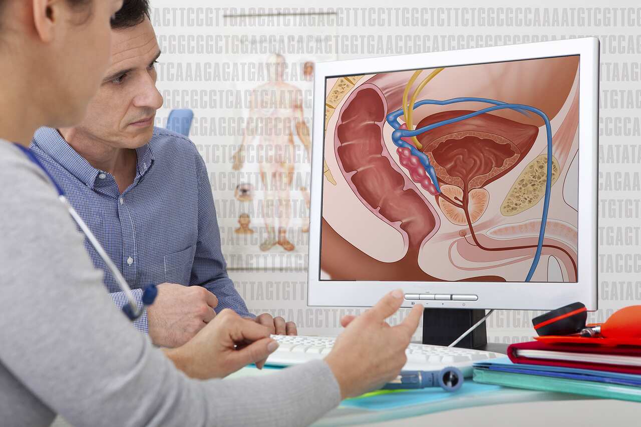 Diagnosing and treatment of prostate cancer
