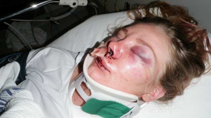 Chloe Victoria Assault