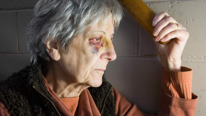 Senior Woman with Black Eyes